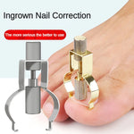 Tool Toe Clamp Stainless Steel Foot Care Tool for Paronychia